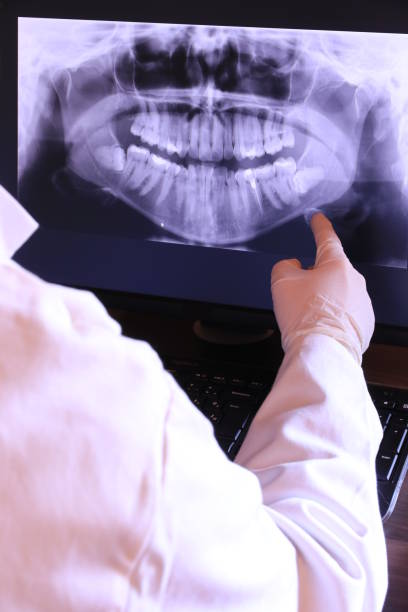 Best Emergency Dental Surgery in Harpersville, AL