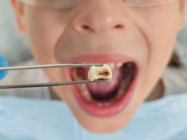Best After-Hours Emergency Dentist in Harpersville, AL